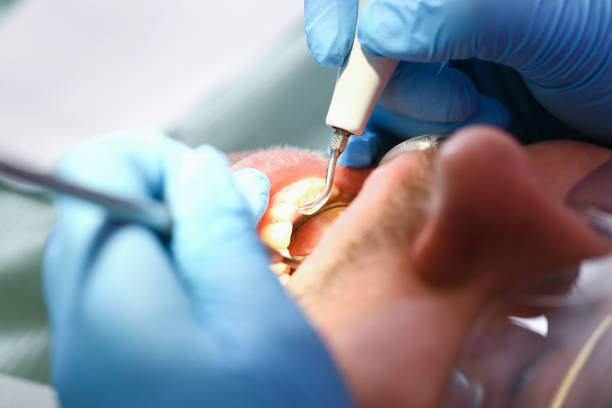 Trusted TX Emergency Dental Service Experts