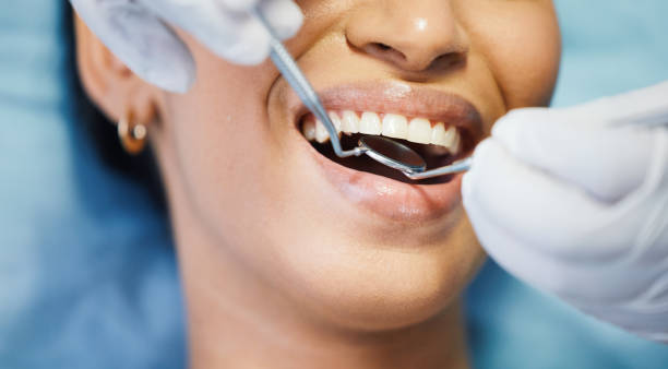 Best Broken or Chipped Tooth Repair in Las Lomas, TX